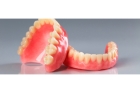 Протезирование зубов пластиночными протезами